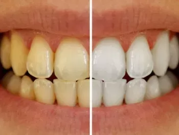 blog-post-image